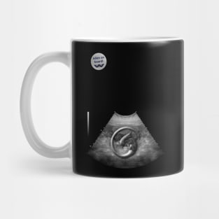 Alien on Board - Ultrasound - badge variant Mug